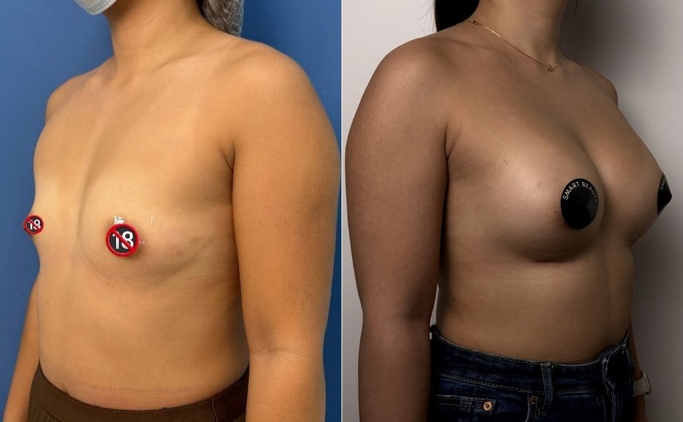 Фистинг қасіретін көрсететін тіркеусіз порно видеолар