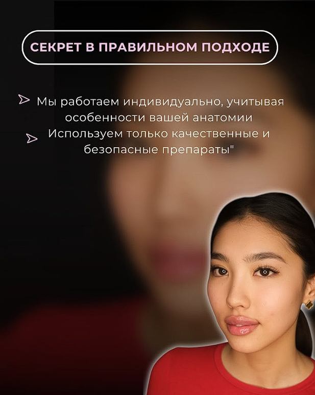 Контурная пластика