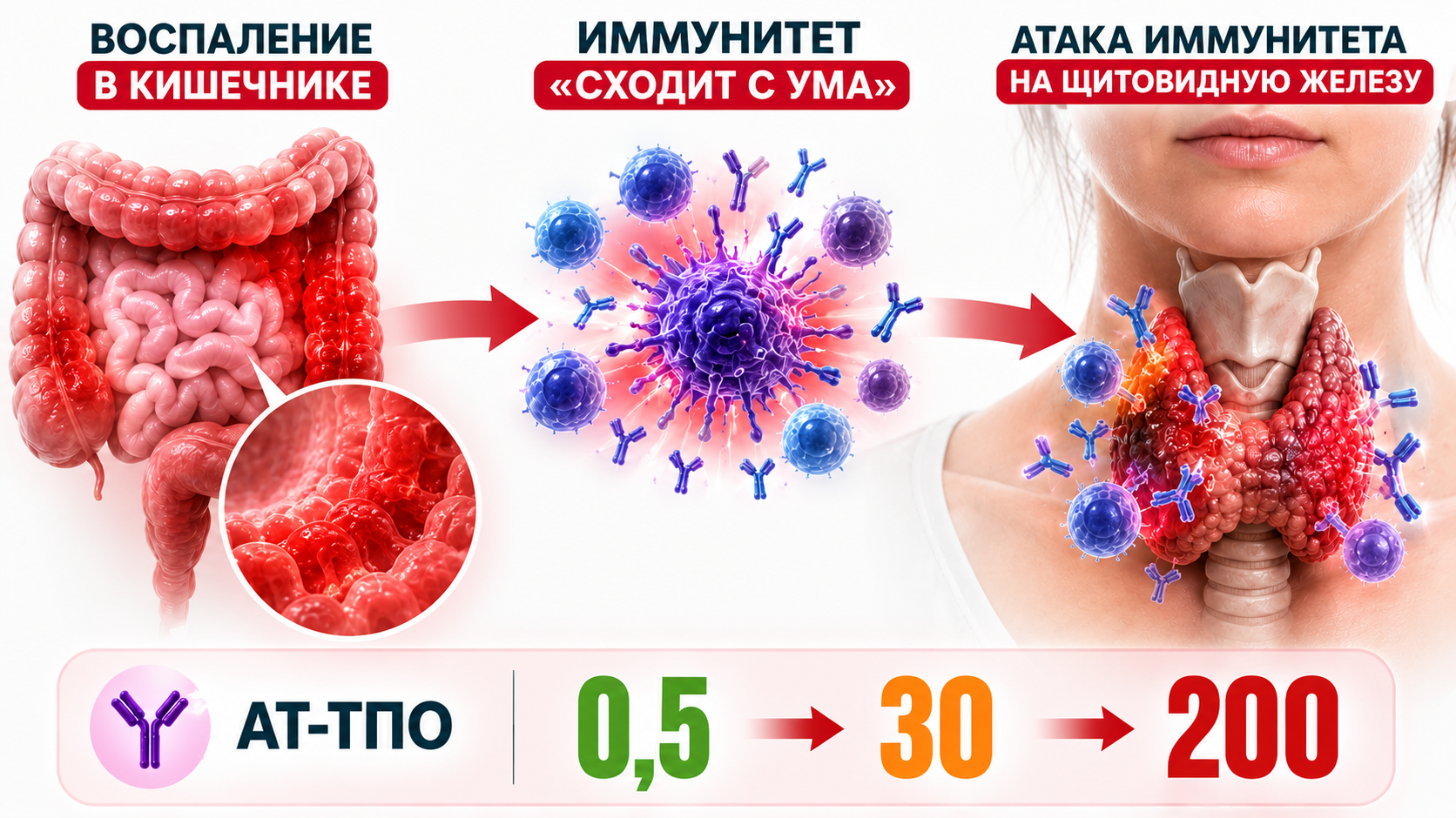 Иммунная система атакует щитовидную железу