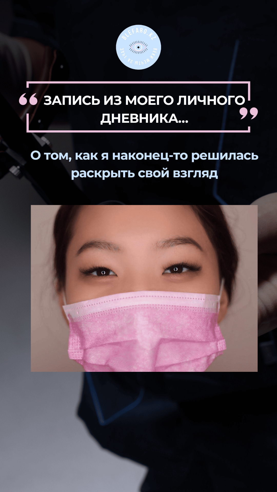 Нитевая блефаропластика