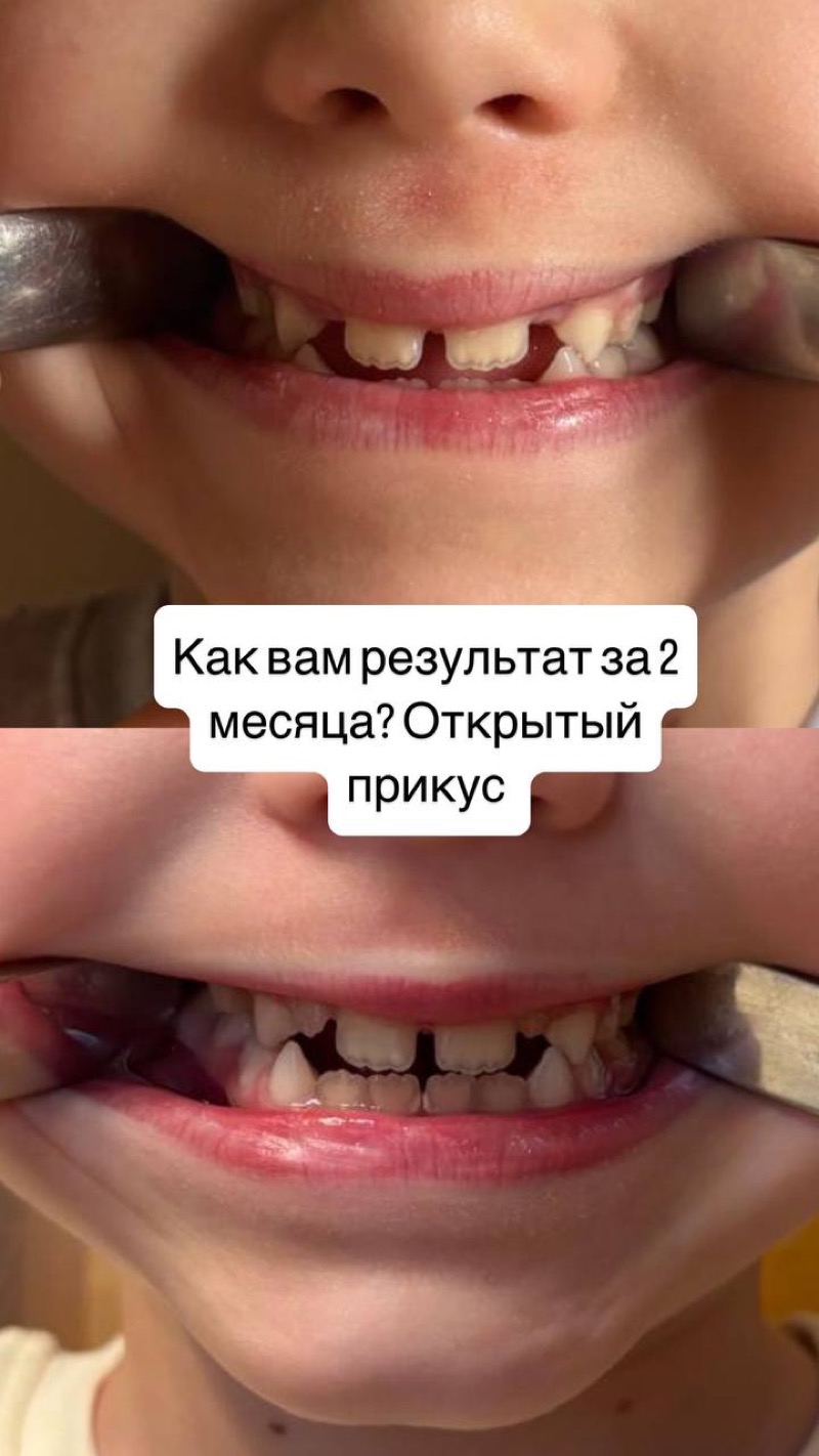 Результат до и после