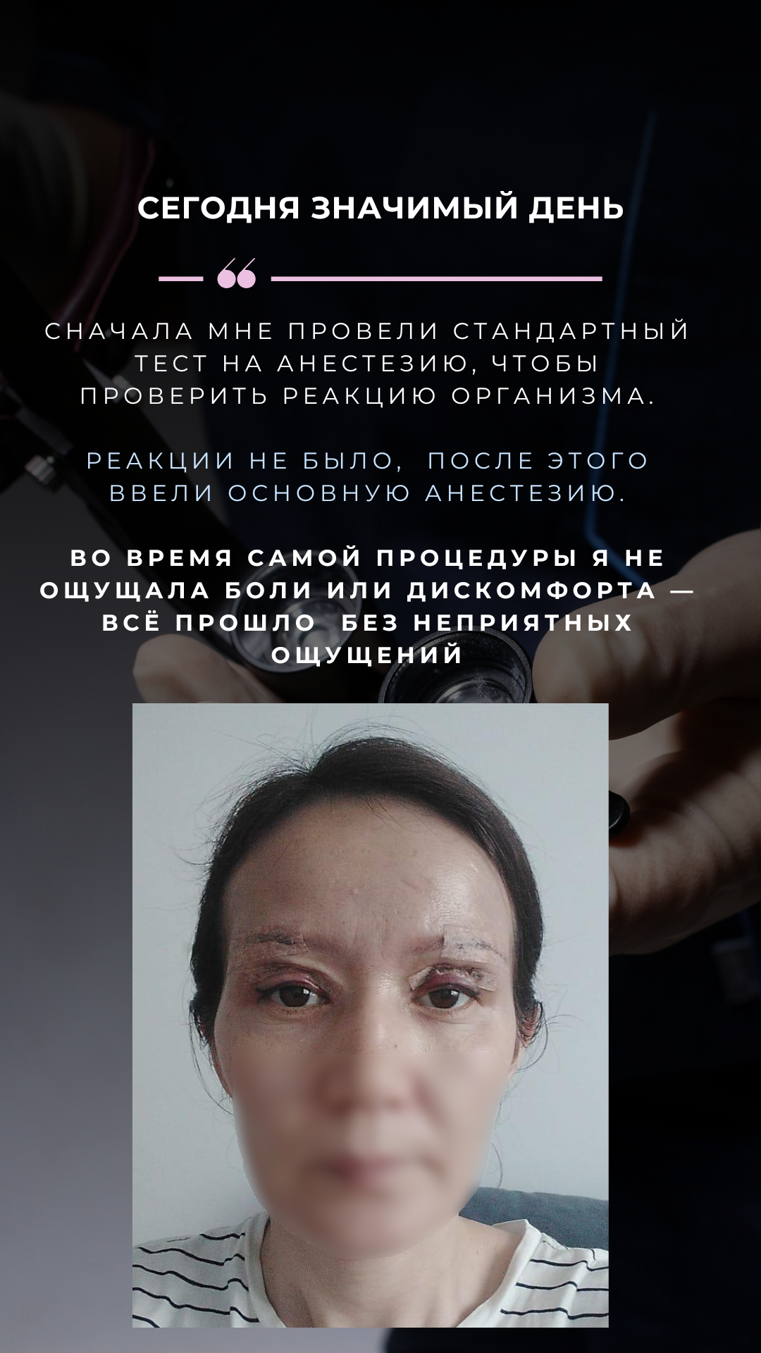 Классическая блефаропластика