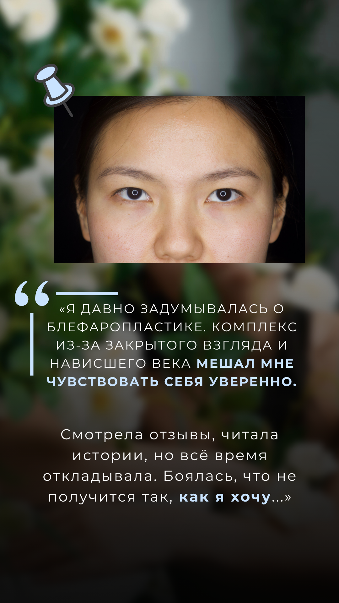 Блефаропластика 3 точки