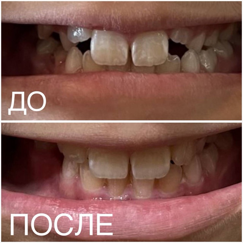 Результат до и после