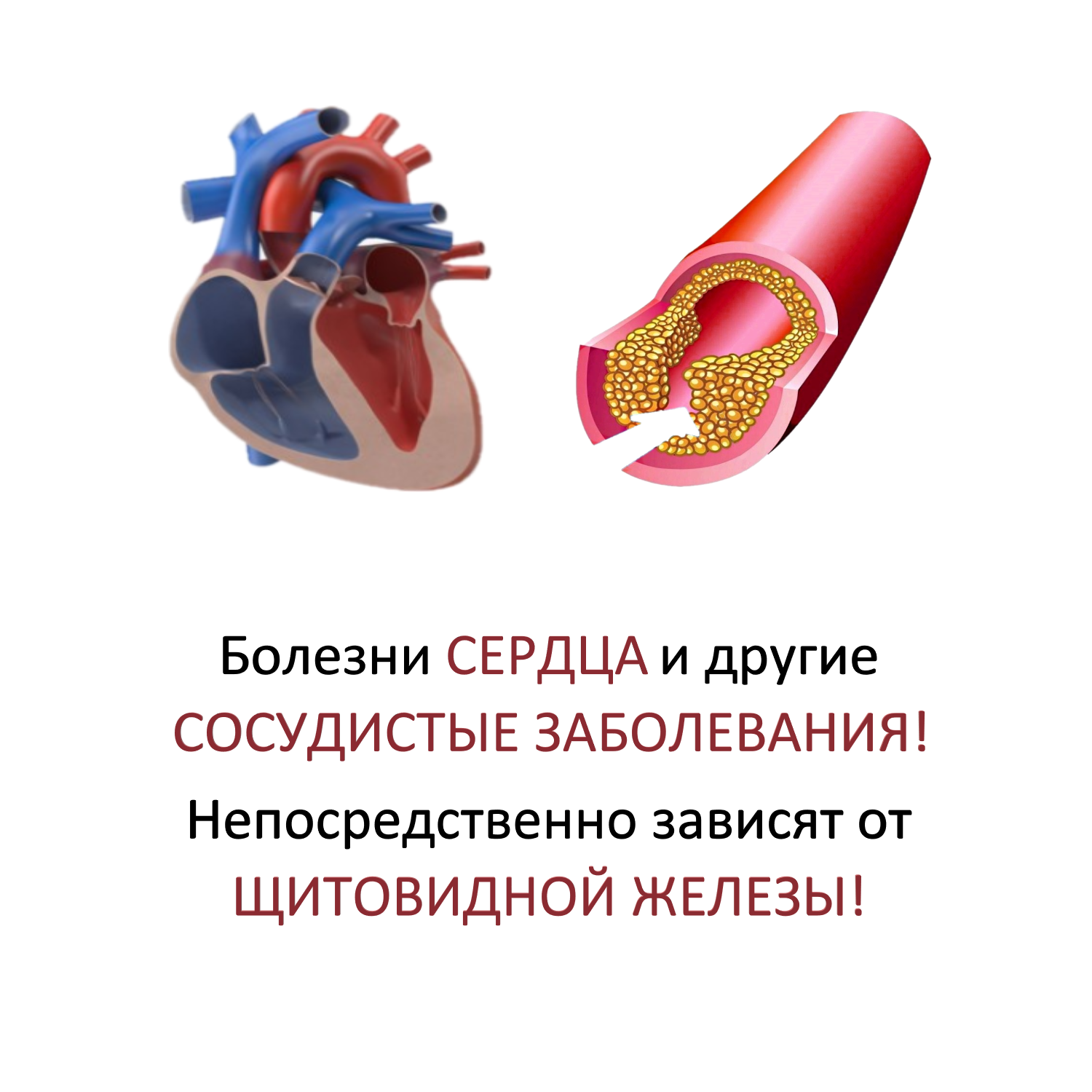 Картинка сердечно сосудистые заболевания