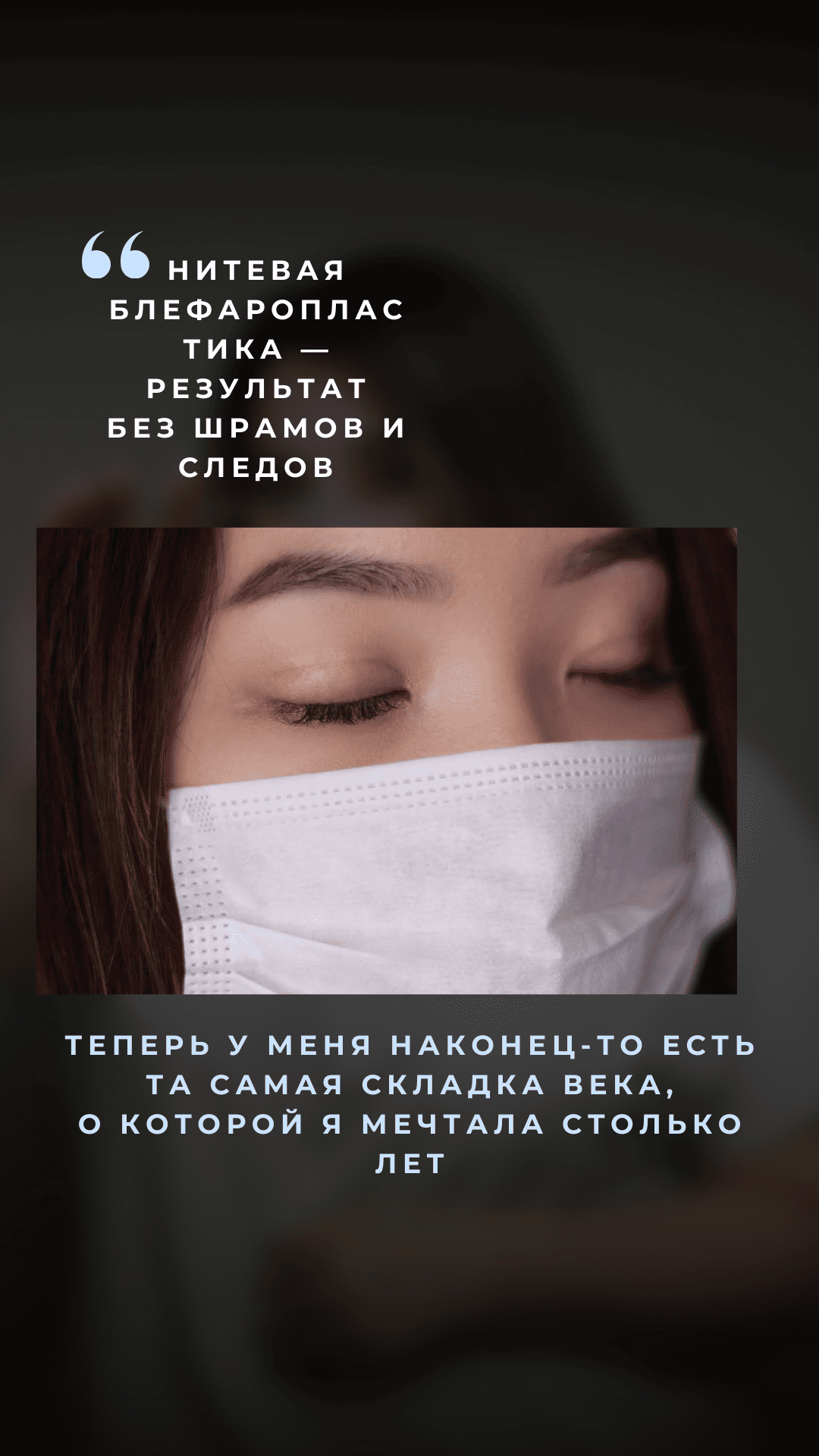 Нитевая блефаропластика