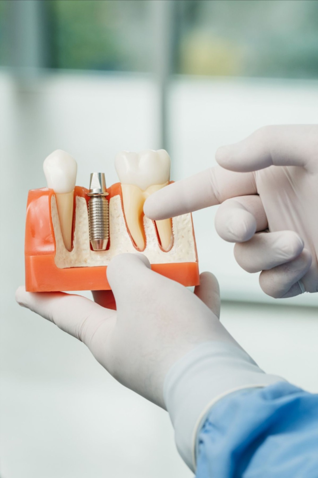 Контроль и связь с клиникой после имплантации