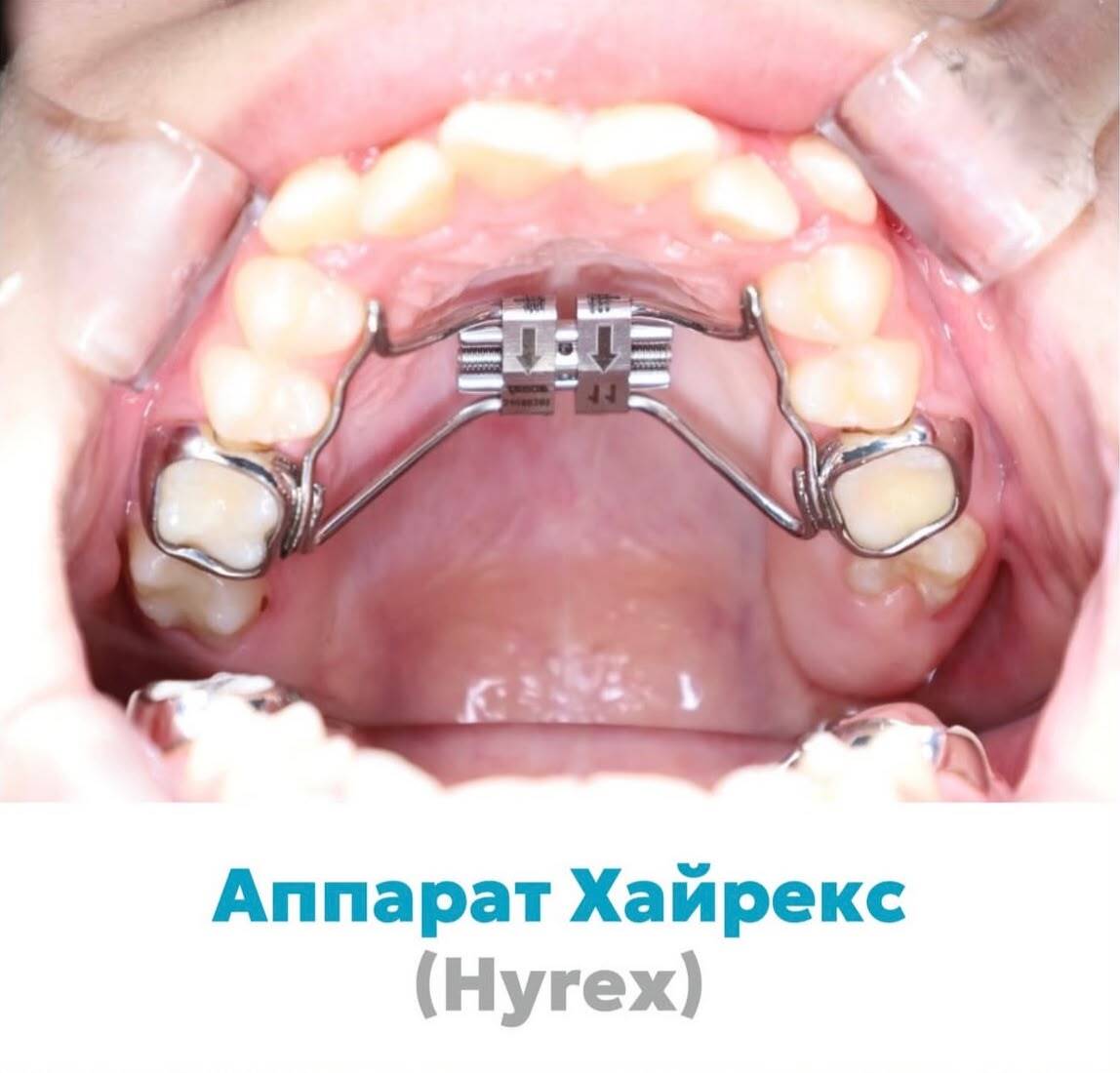 Работа 6