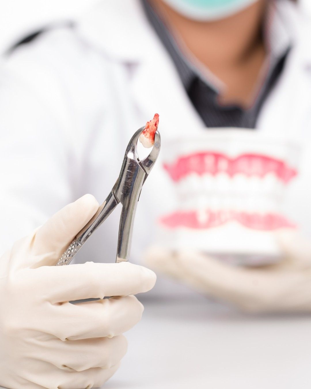 Памятка для пациента после удаления зуба