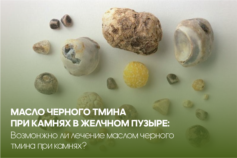 Масло черного тмина при камнях в желчном пузыре
