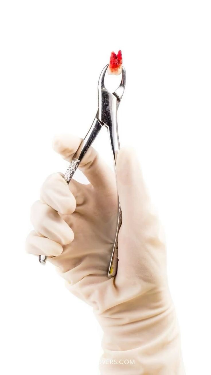 Что важно делать после удаления зуба