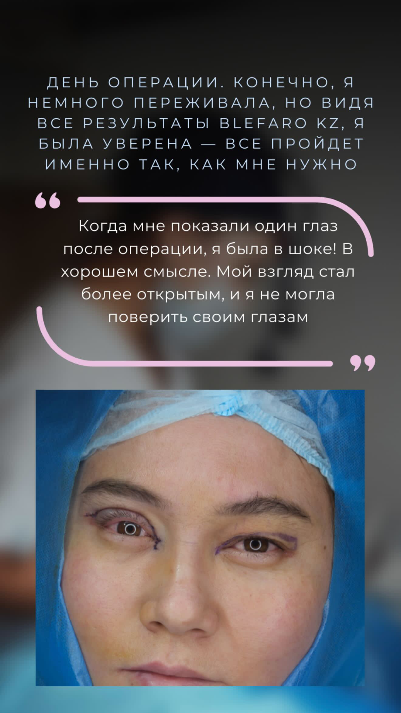 Классическая блефаропластика казахстан