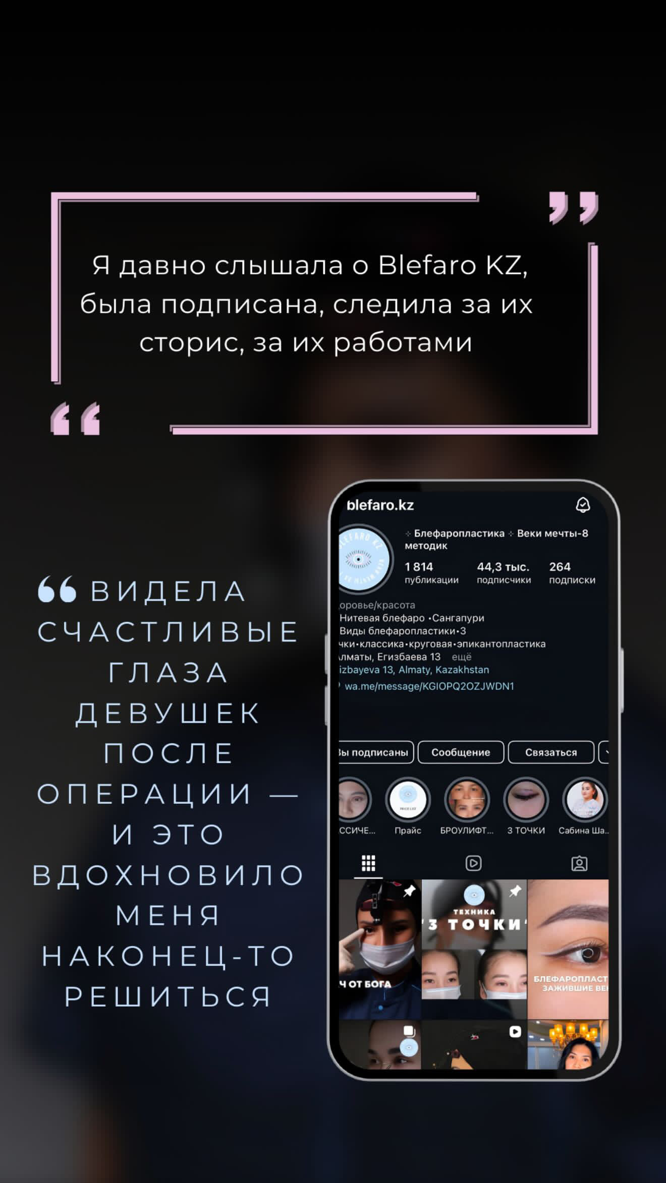 Классическая блефаропластика отзывы