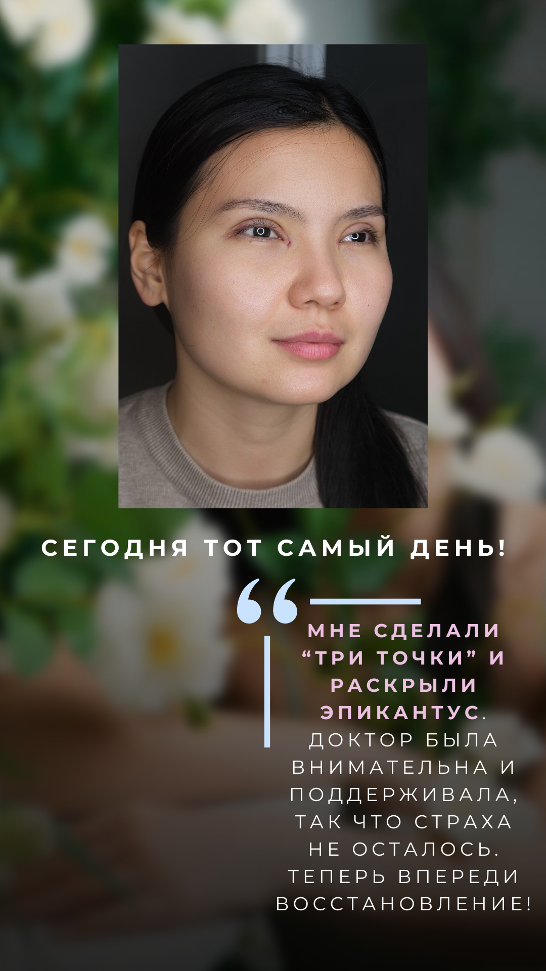 Блефаропластика 3 точки