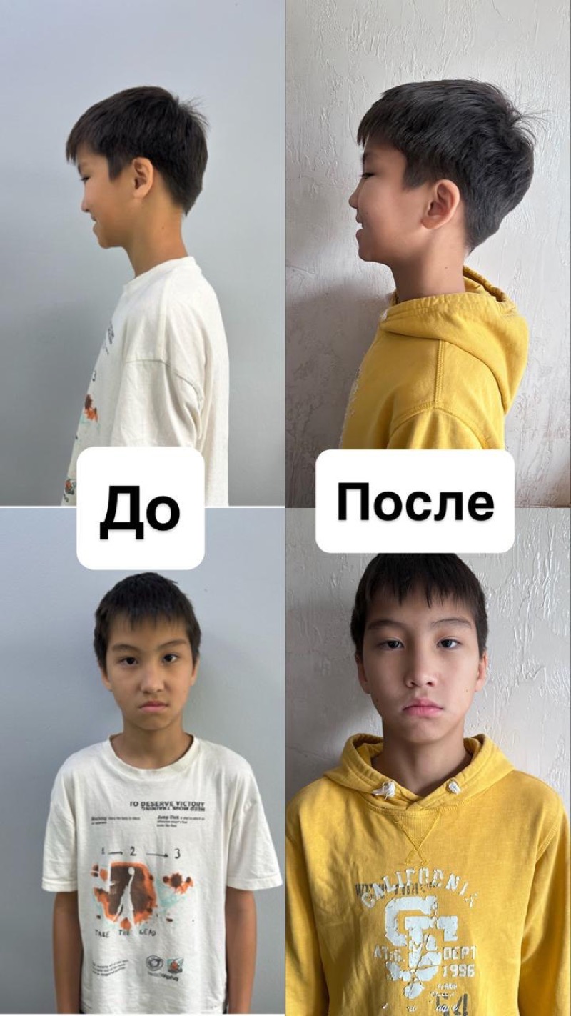 Результат до и после — осанка и профиль