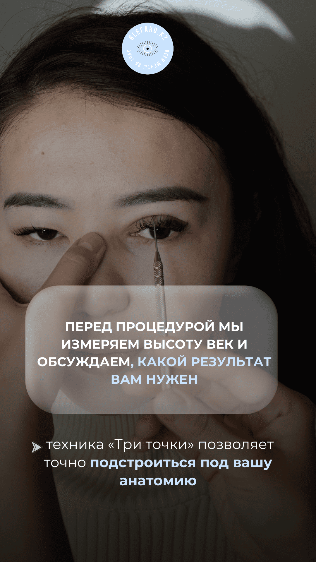 Блефаропластика 3 точки