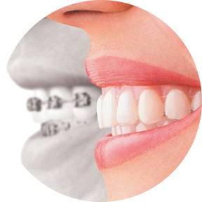 ортодония алматы