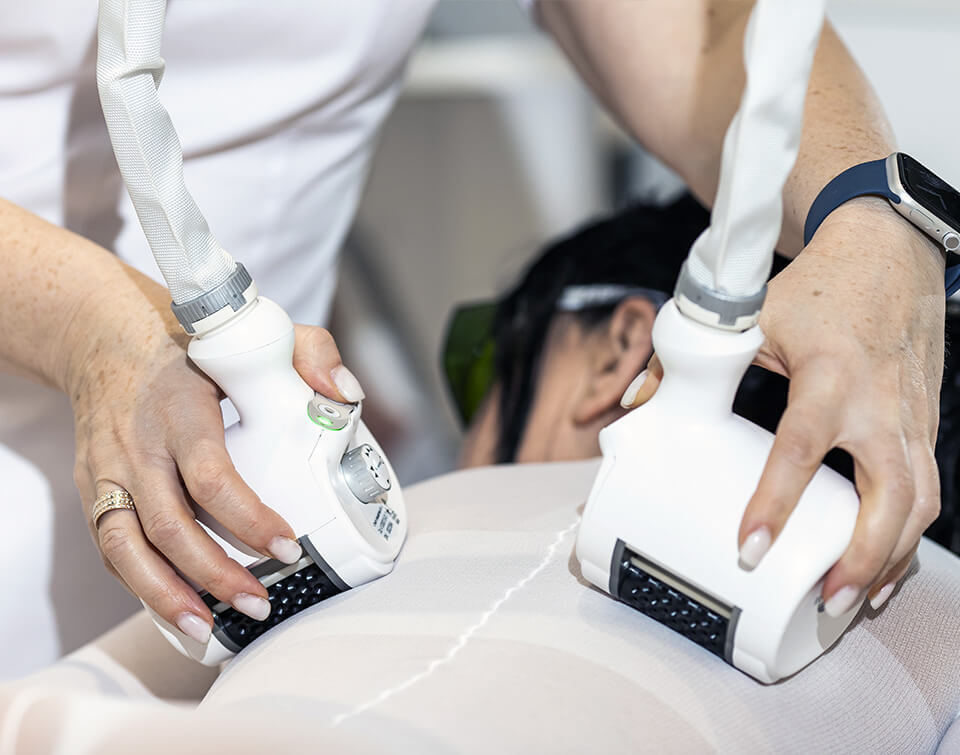 Процедура ICOONE Laser Med в WellAge Clinic