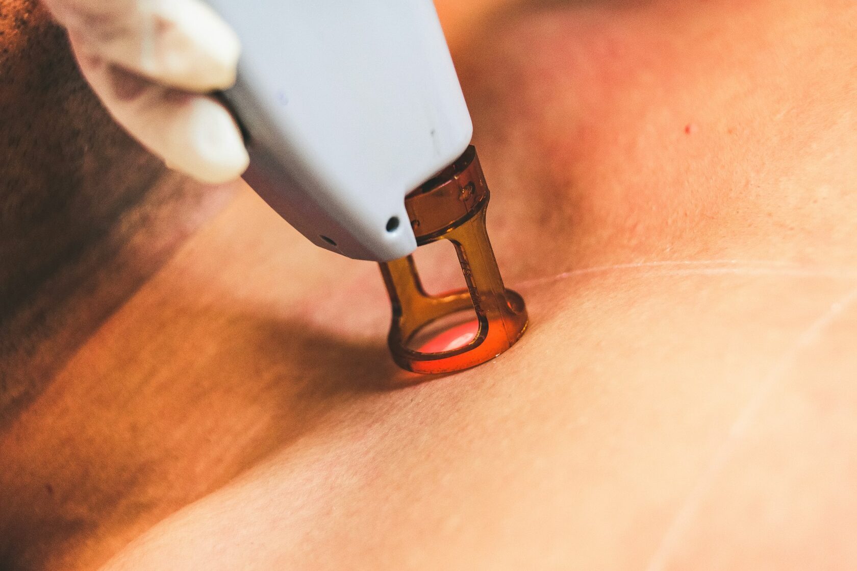 CO₂ Fractional Laser