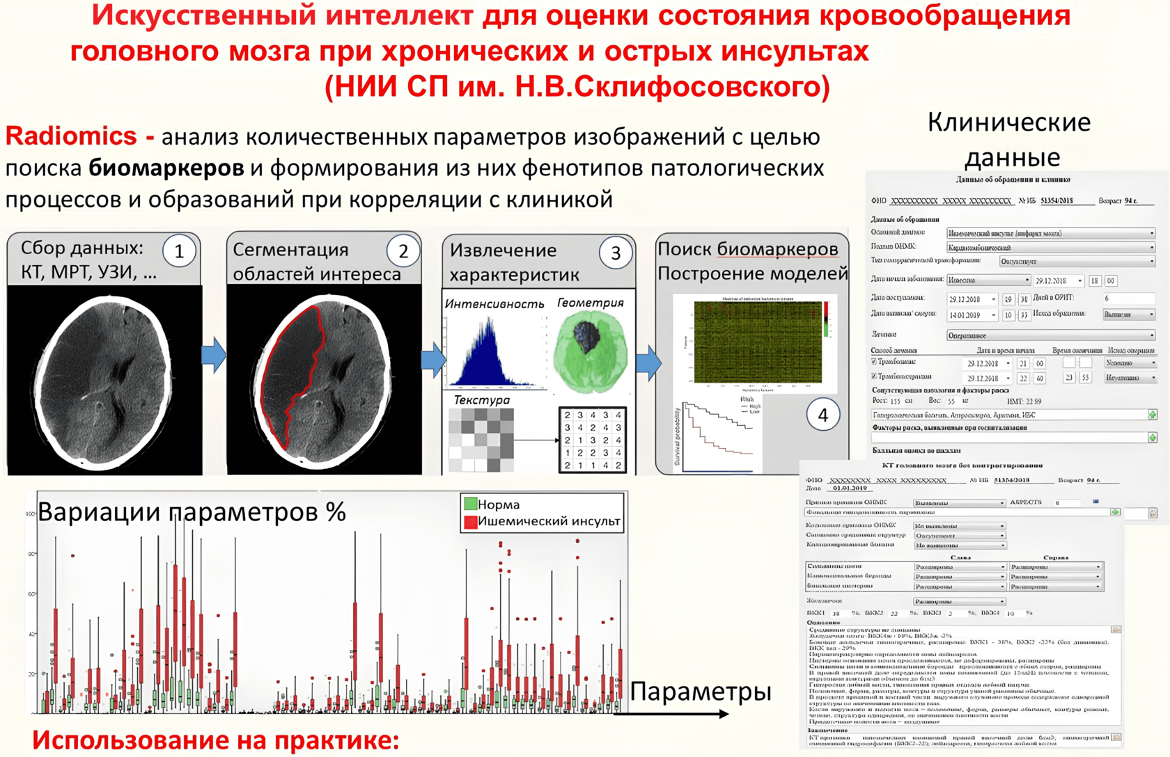 Программа «Multivox ASPECTS» для диагностики ишемического инсульта по  данным КТ