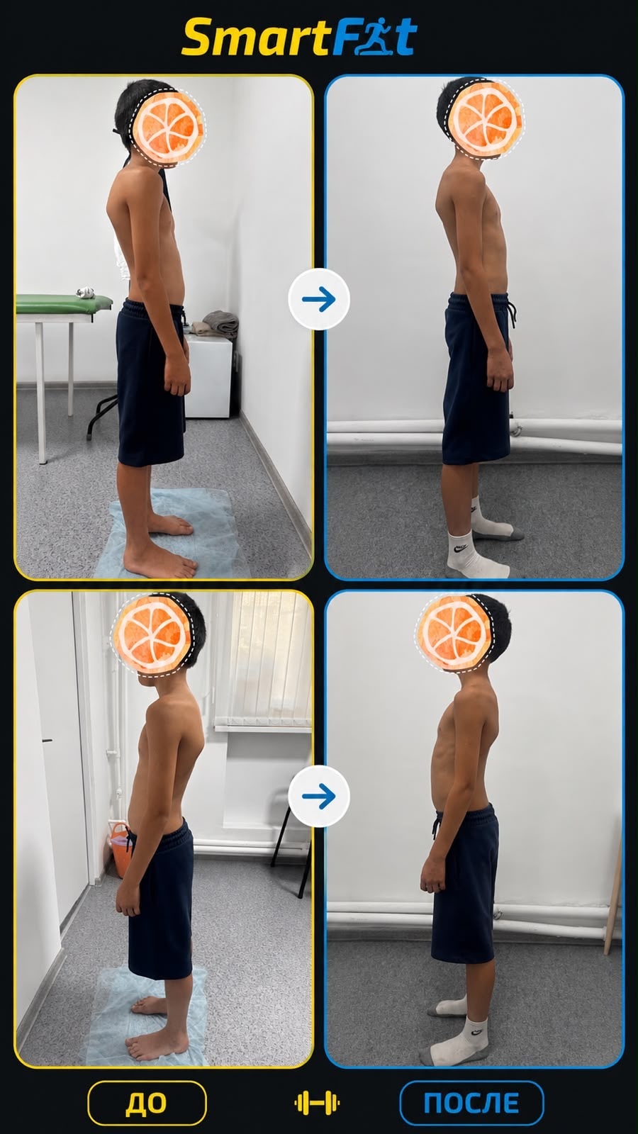 Пример результата программы SmartFit — до и после