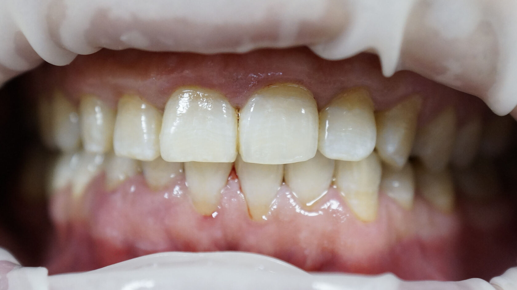 Адекватсыз әйел