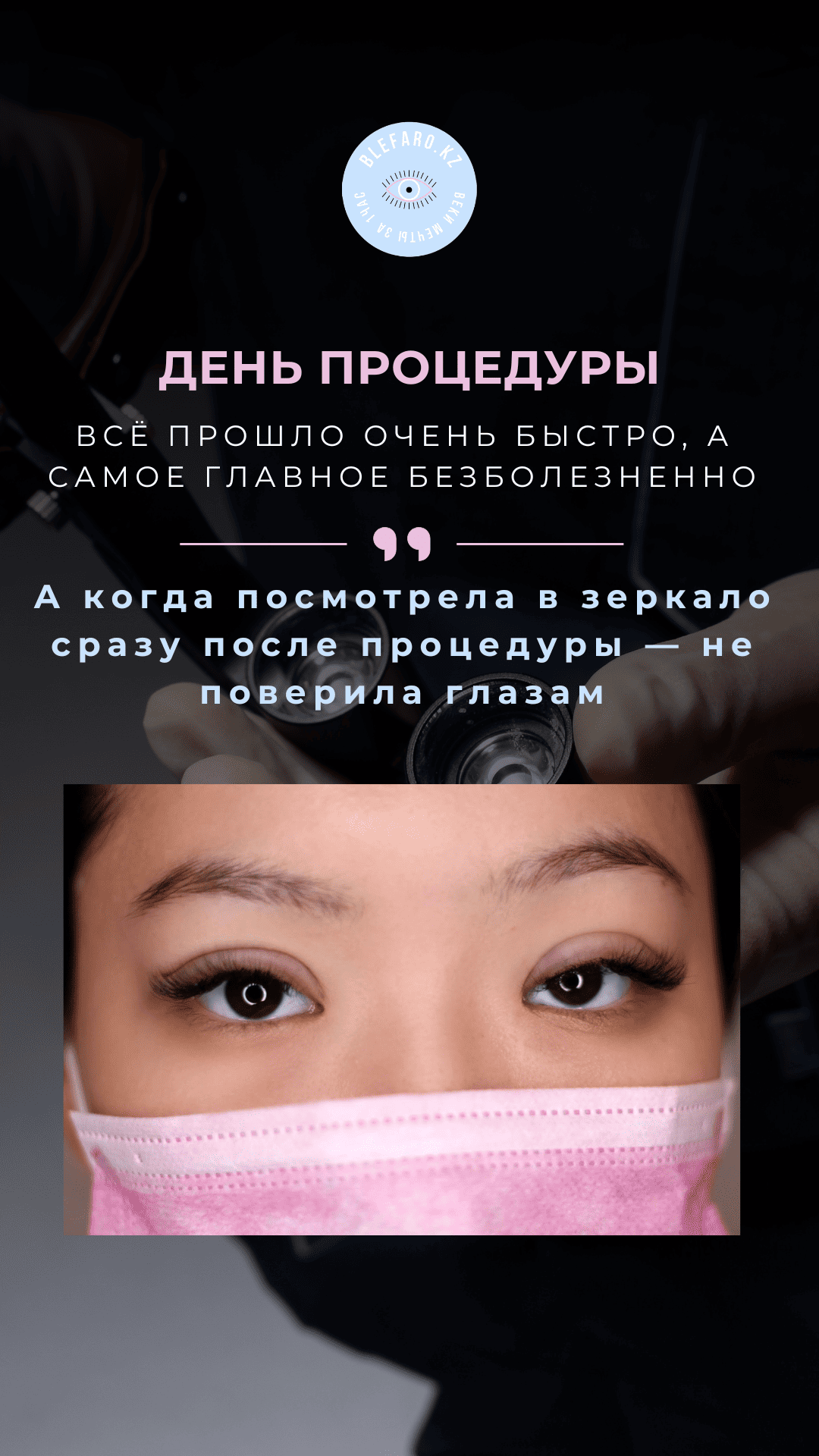 Нитевая блефаропластика
